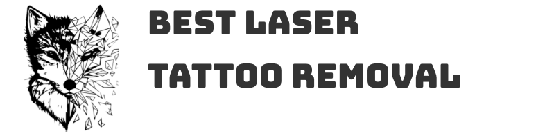 Laser Tattoo Removal Demonstration  Explanation  YouTube